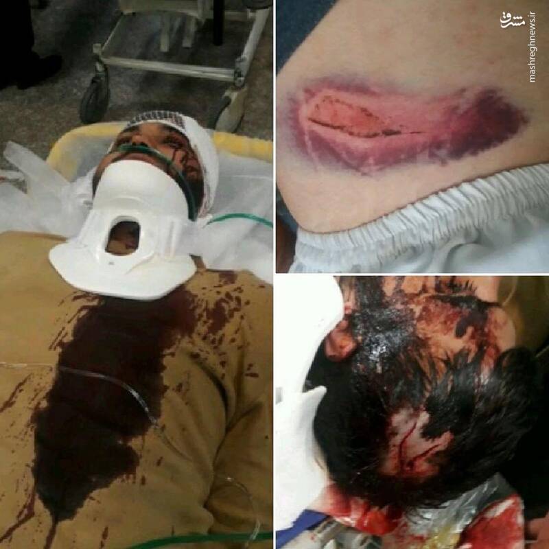 تصاویر دلخراش از حمله به طلبه جوان در مشکین شهر کرج