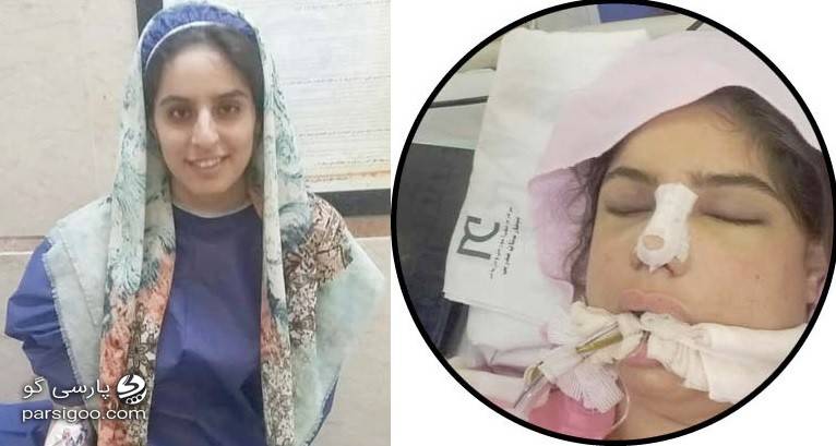 مرگ دختر 18 ساله بعد از جراحی بینی و عمل زیبایی