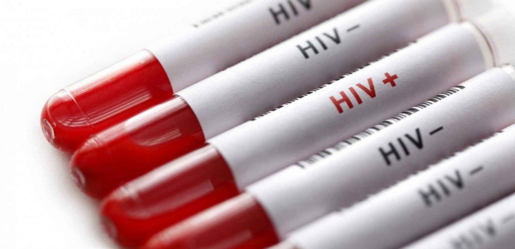 بیماری ایدز اچ آی وی مثبت اچ آی وی منفی. آزمایش ایدز