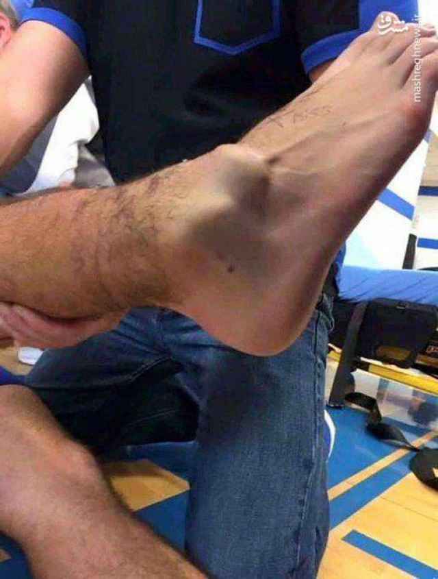 تصویر وحشتناک از شکستن پای آندره گومز